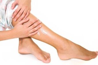 Tratamento de varices
